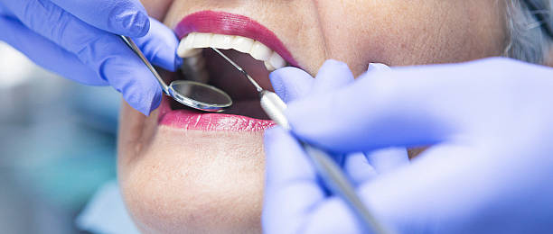 Best Same-Day Emergency Dentist in La Presa, CA